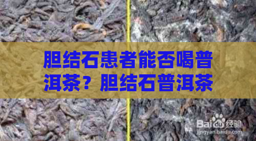 胆结石患者能否喝普洱茶？胆结石普洱茶选择和益处