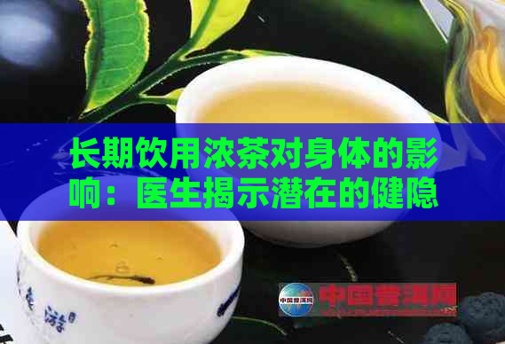 长期饮用浓茶对身体的影响：医生揭示潜在的健隐患