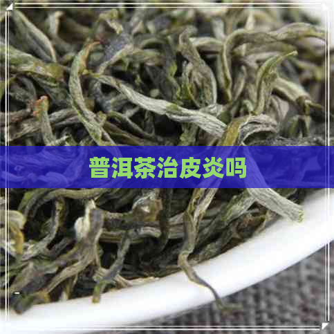 普洱茶治皮炎吗