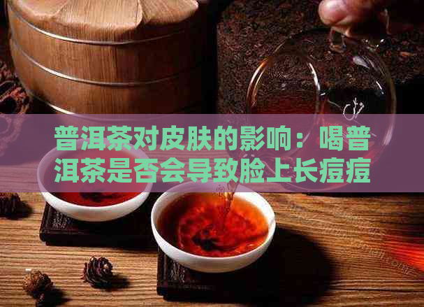 普洱茶对皮肤的影响：喝普洱茶是否会导致脸上长痘痘？如何避免这种现象？