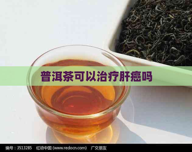 普洱茶可以治疗肝癌吗