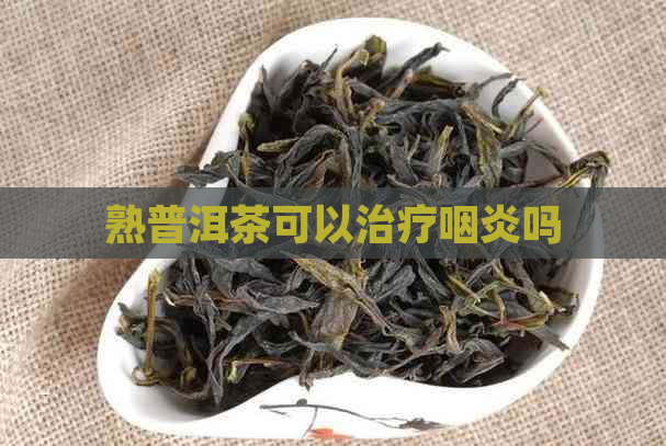 熟普洱茶可以治疗咽炎吗